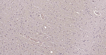 Tau Recombinant Rabbit Monoclonal Antibody