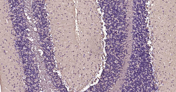Tau Recombinant Rabbit Monoclonal Antibody