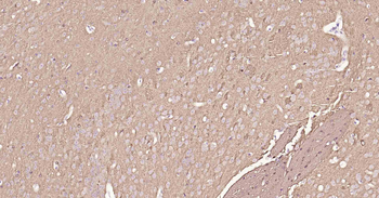 Tau Recombinant Rabbit Monoclonal Antibody