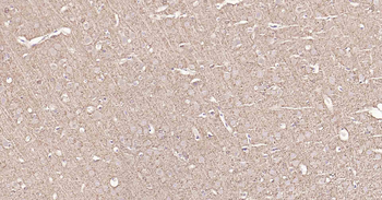 Tau Recombinant Rabbit Monoclonal Antibody