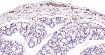 Tau Recombinant Rabbit Monoclonal Antibody