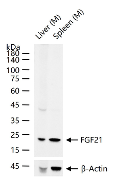 FGF21 Recombinant Rabbit Monoclonal Antibody