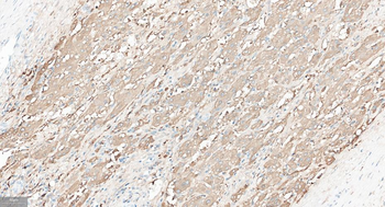 FGF21 Recombinant Rabbit Monoclonal Antibody