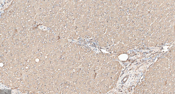 FGF21 Recombinant Rabbit Monoclonal Antibody