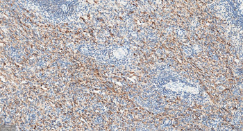 FGF21 Recombinant Rabbit Monoclonal Antibody