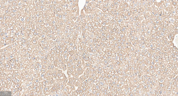 FGF21 Recombinant Rabbit Monoclonal Antibody