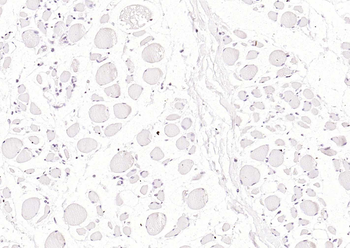 Cardiac Troponin I/TNIC Mouse Monoclonal Antibody