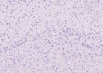 Cardiac Troponin I/TNIC Mouse Monoclonal Antibody