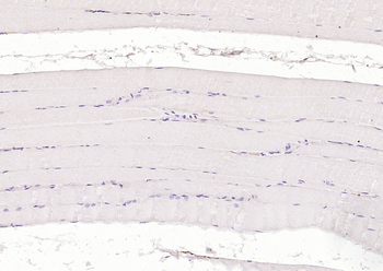 Cardiac Troponin I/TNIC Mouse Monoclonal Antibody