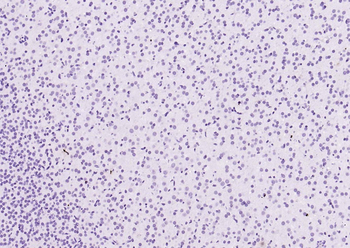 Cardiac Troponin I/TNIC Mouse Monoclonal Antibody
