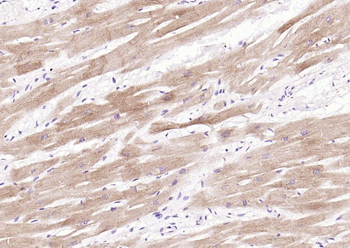 Cardiac Troponin I/TNIC Mouse Monoclonal Antibody