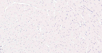 Ki67 Recombinant Rabbit Monoclonal Antibody
