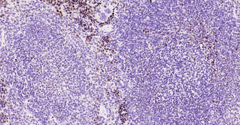 Ki67 Recombinant Rabbit Monoclonal Antibody