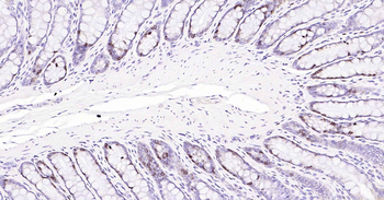 Ki67 Recombinant Rabbit Monoclonal Antibody