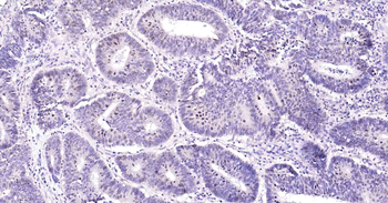 Ki67 Recombinant Rabbit Monoclonal Antibody