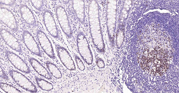 Ki67 Recombinant Rabbit Monoclonal Antibody