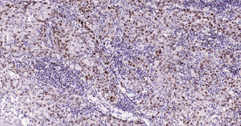 Ki67 Recombinant Rabbit Monoclonal Antibody