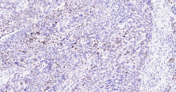 Ki67 Recombinant Rabbit Monoclonal Antibody
