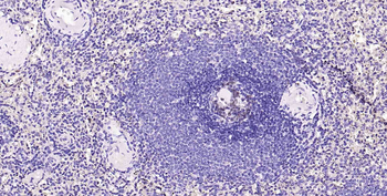 Ki67 Recombinant Rabbit Monoclonal Antibody