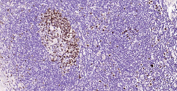 Ki67 Recombinant Rabbit Monoclonal Antibody