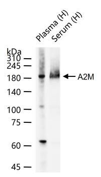 A2M Recombinant Rabbit Monoclonal Antibody