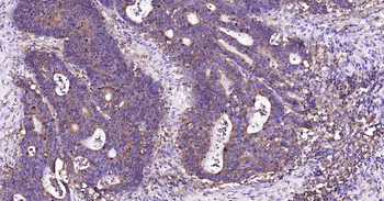 A2M Recombinant Rabbit Monoclonal Antibody