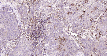 A2M Recombinant Rabbit Monoclonal Antibody