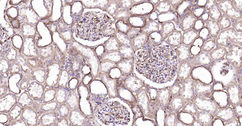 A2M Recombinant Rabbit Monoclonal Antibody