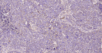 A2M Recombinant Rabbit Monoclonal Antibody