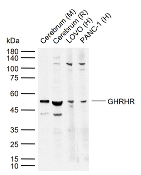 GHRHR Rabbit Polyclonal Antibody