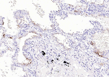 Mucin-1 Mouse Monoclonal Antibody