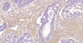 Collagen I Mouse Monoclonal Antibody