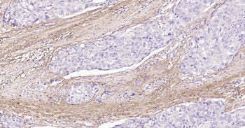 Collagen I Mouse Monoclonal Antibody