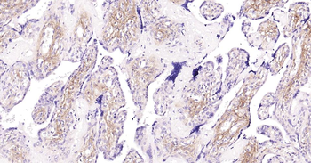 Collagen I Mouse Monoclonal Antibody