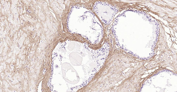 Collagen I Mouse Monoclonal Antibody