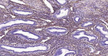 Collagen I Mouse Monoclonal Antibody