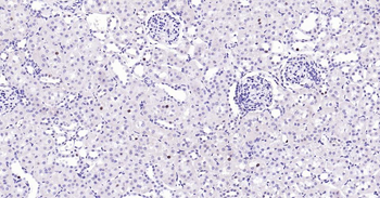 PCNA Rabbit Polyclonal Antibody