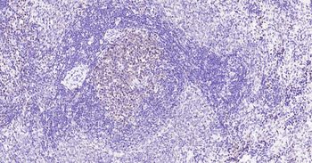 PCNA Rabbit Polyclonal Antibody
