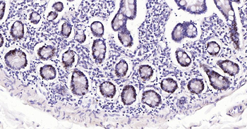 PCNA Rabbit Polyclonal Antibody