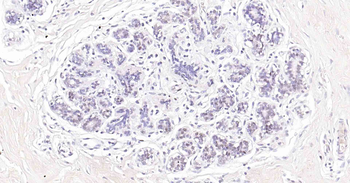 SOX10 Recombinant Rabbit Monoclonal Antibody