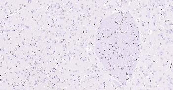 SOX10 Recombinant Rabbit Monoclonal Antibody