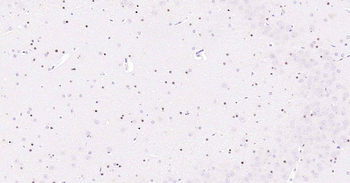 SOX10 Recombinant Rabbit Monoclonal Antibody