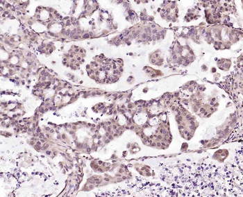 Phospho-RAD9 (Ser336) Rabbit Polyclonal Antibody