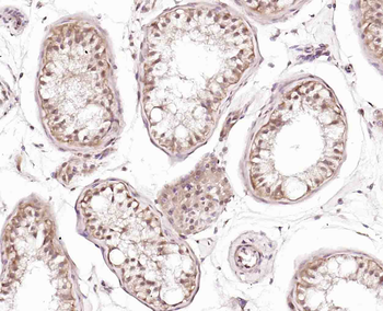 Phospho-RAD9 (Ser336) Rabbit Polyclonal Antibody