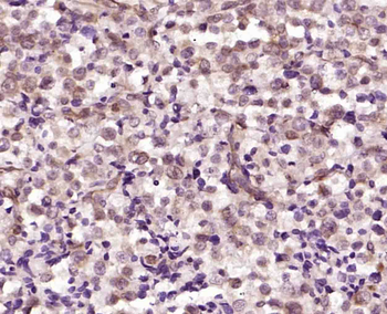 Phospho-RAD9 (Ser336) Rabbit Polyclonal Antibody