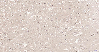 Proteasome 19S S5A Rabbit Polyclonal Antibody