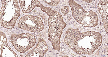 Proteasome 19S S5A Rabbit Polyclonal Antibody