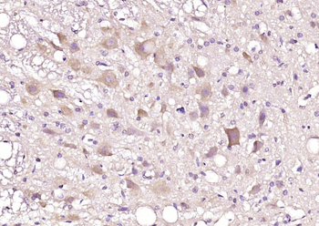 PP4R3B Rabbit Polyclonal Antibody