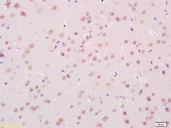 Ube2L6 Rabbit Polyclonal Antibody