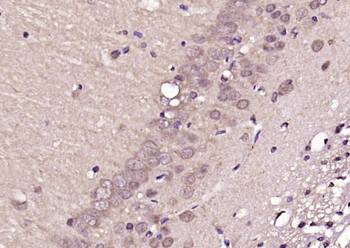 Ube2G1 Rabbit Polyclonal Antibody